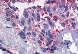 Invitrogen GPR56 Polyclonal Antibody 50 μg; Unconjugated:Antibodies,