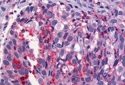 Invitrogen GPR56 Polyclonal Antibody 50 μg; Unconjugated:Antibodies,