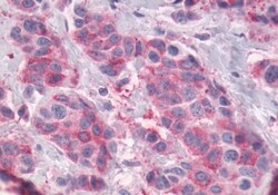 Invitrogen GPR56 Polyclonal Antibody 50 μg; Unconjugated:Antibodies,