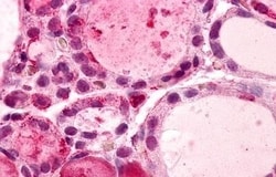 Invitrogen GPR56 Polyclonal Antibody 50 &mu;g | Buy Online | Invitrogen&trade; | Fisher Scientific