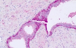 Invitrogen GPR56 Polyclonal Antibody 50 &mu;g; Unconjugated:Antibodies,