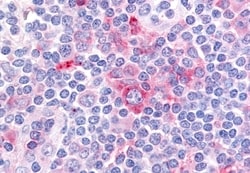 Invitrogen GPR62 Polyclonal Antibody 50 &mu;g; Unconjugated:Antibodies,