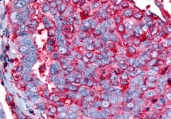 Invitrogen GPR63 Polyclonal Antibody 50 μg; Unconjugated:Antibodies,