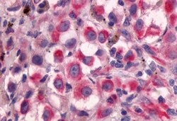 Invitrogen GPR64 Polyclonal Antibody 50 &mu;g | Buy Online | Invitrogen&trade; | Fisher Scientific