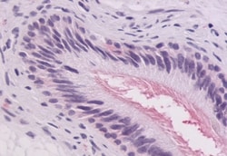GPR64 Polyclonal Antibody:Antibodies, Polyclonal