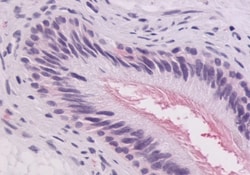 GPR64 Polyclonal Antibody:Antibodies, Polyclonal