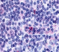 Invitrogen GPR65 Polyclonal Antibody 50 μg; Unconjugated:Antibodies,