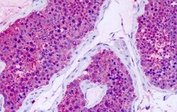 GPR75 Polyclonal Antibody:Antibodies, Polyclonal