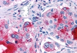 Invitrogen GPR82 Polyclonal Antibody 50 &mu;g; Unconjugated:Antibodies,