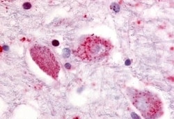 Invitrogen GPR85 Polyclonal Antibody 50 &mu;g; Unconjugated:Antibodies,