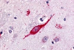 Invitrogen GPR85 Polyclonal Antibody 50 &mu;g | Buy Online | Invitrogen&trade; | Fisher Scientific