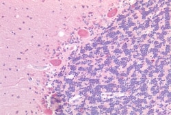 Invitrogen GPR87 Polyclonal Antibody 50 &mu;g | Buy Online | Invitrogen&trade; | Fisher Scientific