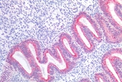 Invitrogen GPR87 Polyclonal Antibody 50 &mu;g | Buy Online | Invitrogen&trade; | Fisher Scientific