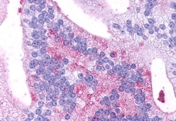 GPR88 Polyclonal Antibody:Antibodies, Polyclonal