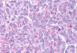 GPR88 Polyclonal Antibody:Antibodies, Polyclonal