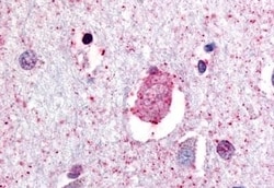 GPR88 Polyclonal Antibody:Antibodies, Polyclonal
