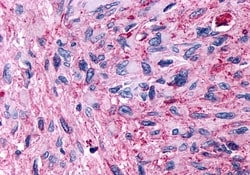 Invitrogen GPR89A Polyclonal Antibody 50 &mu;g; Unconjugated:Antibodies,