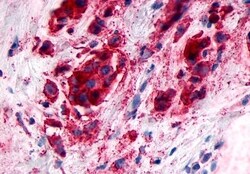 Invitrogen GPR89A Polyclonal Antibody 50 &mu;g; Unconjugated:Antibodies,