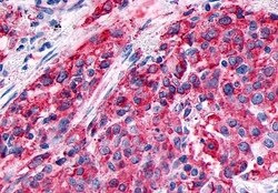 Invitrogen GPR89A Polyclonal Antibody 50 &mu;g; Unconjugated:Antibodies,