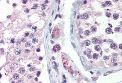 Invitrogen GPR98 Polyclonal Antibody 50 &mu;g; Unconjugated:Antibodies,