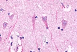 Invitrogen GPR98 Polyclonal Antibody 50 &mu;g; Unconjugated:Antibodies,