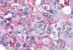 RAI3 Polyclonal Antibody:Antibodies, Polyclonal
