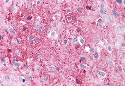 RAI3 Polyclonal Antibody:Antibodies, Polyclonal