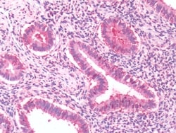 RAI3 Polyclonal Antibody:Antibodies, Polyclonal