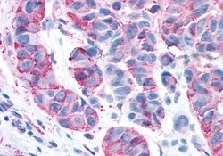 RAI3 Polyclonal Antibody:Antibodies, Polyclonal