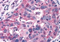 RAI3 Polyclonal Antibody:Antibodies, Polyclonal