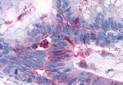 RAI3 Polyclonal Antibody:Antibodies, Polyclonal