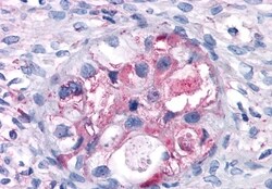 RAI3 Polyclonal Antibody:Antibodies, Polyclonal