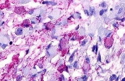 Invitrogen GPRC5D Polyclonal Antibody 50 &mu;g | Buy Online | Invitrogen&trade; | Fisher Scientific