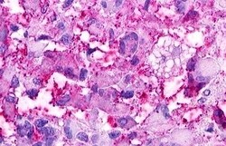 Invitrogen GPRC5D Polyclonal Antibody 50 &mu;g; Unconjugated:Antibodies,
