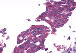 Invitrogen GPRC6A Polyclonal Antibody 50 &mu;g | Buy Online | Invitrogen&trade; | Fisher Scientific