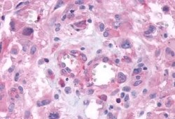 Invitrogen GPRC6A Polyclonal Antibody 50 &mu;g | Buy Online | Invitrogen&trade; | Fisher Scientific