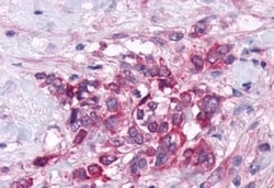 Invitrogen GPRC6A Polyclonal Antibody 50 &mu;g | Buy Online | Invitrogen&trade; | Fisher Scientific