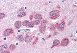 Invitrogen GPRC6A Polyclonal Antibody 50 &mu;g | Buy Online | Invitrogen&trade; | Fisher Scientific