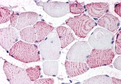 Invitrogen GPRC6A Polyclonal Antibody 50 &mu;g | Buy Online | Invitrogen&trade; | Fisher Scientific