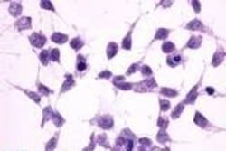 Invitrogen mGluR2 Polyclonal Antibody 50 &mu;g; Unconjugated:Antibodies,