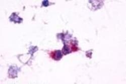 Invitrogen mGluR2 Polyclonal Antibody 50 &mu;g; Unconjugated:Antibodies,
