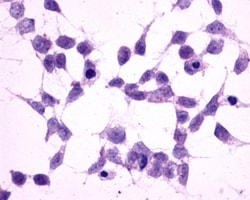 Invitrogen mGluR2 Polyclonal Antibody 50 &mu;g; Unconjugated:Antibodies,