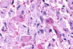 Invitrogen mGluR2 Polyclonal Antibody 50 &mu;g; Unconjugated:Antibodies,