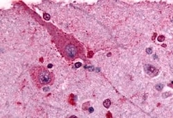 Invitrogen mGluR2 Polyclonal Antibody 50 μg; Unconjugated:Antibodies,