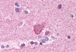 Invitrogen mGluR3 Polyclonal Antibody 50 &mu;g; Unconjugated:Antibodies,