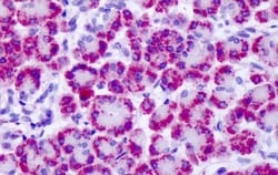 Invitrogen mGluR4 Polyclonal Antibody 50 &mu;g; Unconjugated:Anticuerpos