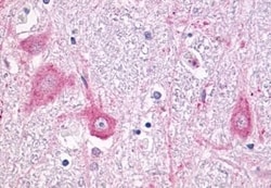 Invitrogen mGluR5 Polyclonal Antibody 50 &mu;g; Unconjugated:Antibodies,