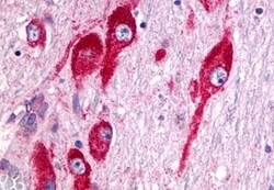 Invitrogen mGluR5 Polyclonal Antibody 50 &mu;g; Unconjugated:Antibodies,