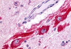 Invitrogen mGluR5 Polyclonal Antibody 50 &mu;g; Unconjugated:Antibodies,