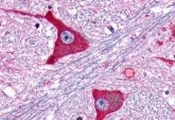 Invitrogen mGluR5 Polyclonal Antibody 50 &mu;g; Unconjugated:Antibodies,